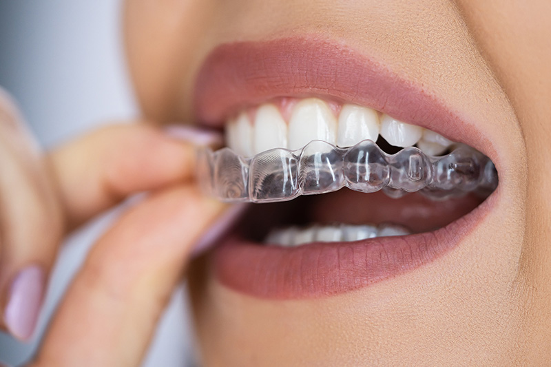 Orthodontics in Worth